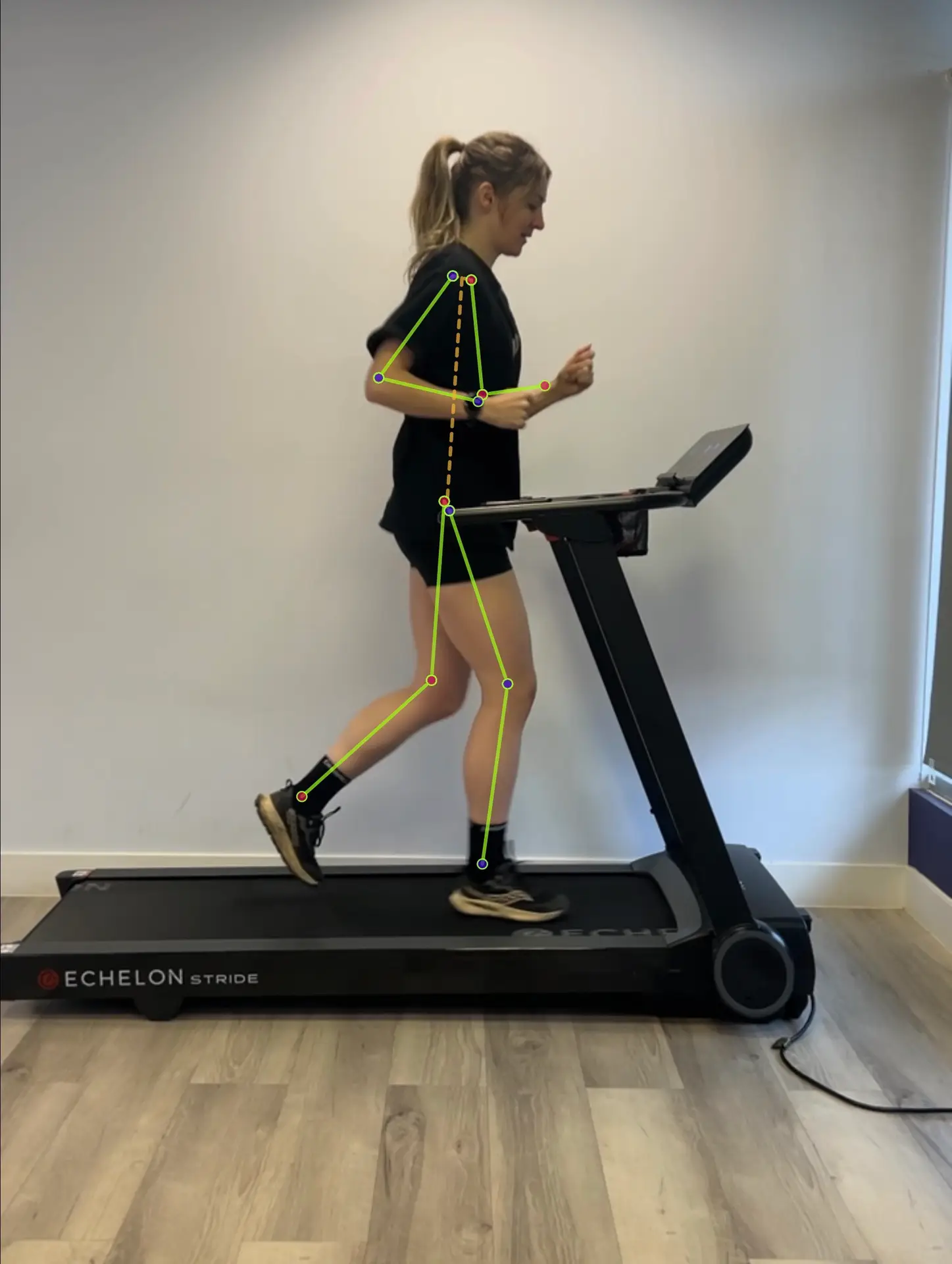 A runner undergoing a running assessment on a treadmill